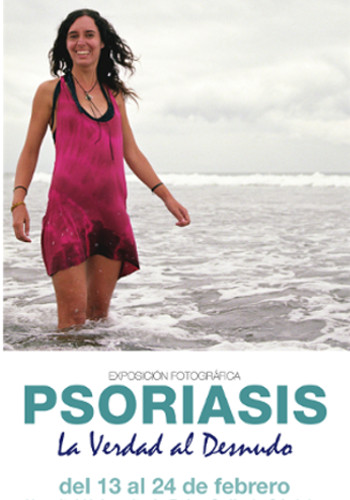 La Verdad al Desnudo - Psoriasis